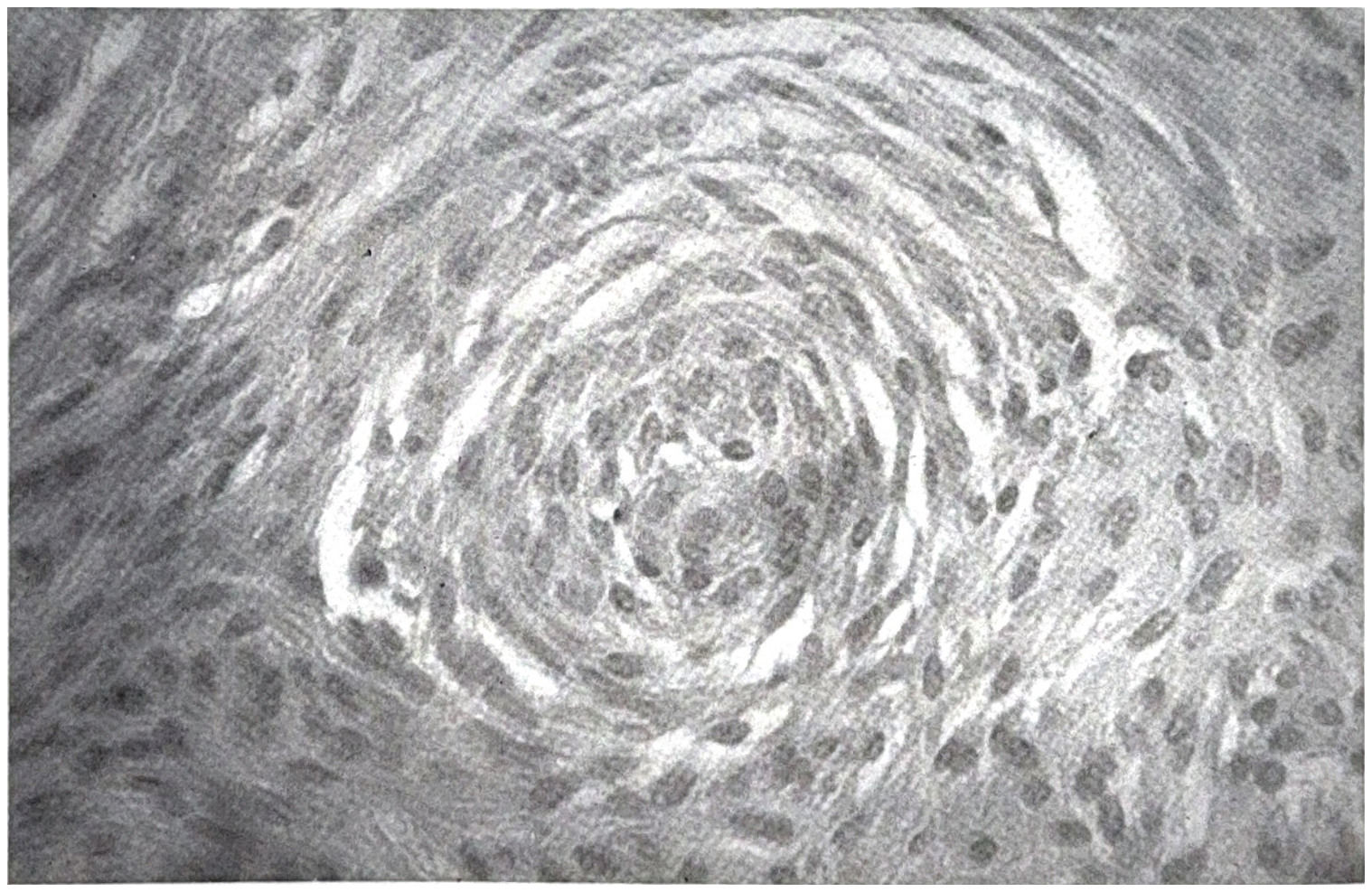 รูปที่ 3.88 ข. ภาพขยายให้เห็นเซลล์ของ whorl